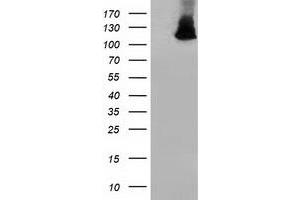 Western Blotting (WB) image for anti-Microtubule Associated Monoxygenase, Calponin and LIM Domain Containing 1 (MICAL1) antibody (ABIN1499465) (MICAL1 anticorps)