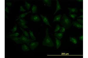 Image no. 3 for anti-Zic Family Member 4 (ZIC4) (AA 249-320) antibody (ABIN466251) (ZIC4 anticorps  (AA 249-320))