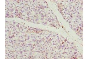 Immunohistochemistry of paraffin-embedded human pancreatic tissue using ABIN7148168 at dilution of 1:100 (CCDC89 anticorps  (AA 1-200))