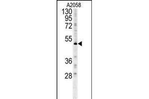 FOXC2 Antibody (Center ) (ABIN651936 and ABIN2840463) western blot analysis in  cell line lysates (15 μg/lane). (FOXC2 anticorps  (AA 159-186))
