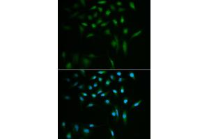 Immunofluorescence analysis of A549 cells using SUMO3 antibody (ABIN5971585). (SUMO3 anticorps)