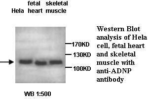 Image no. 1 for anti-Activity-Dependent Neuroprotector Homeobox (ADNP) antibody (ABIN1574495) (ADNP anticorps)