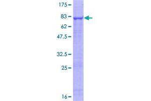 Image no. 1 for serine/threonine Kinase 40 (STK40) (AA 1-435) protein (GST tag) (ABIN1321710)