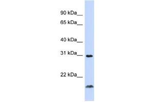WB Suggested Anti-TNFSF14 Antibody Titration:  0. (TNFSF14 anticorps  (Middle Region))