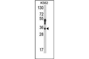Western blot analysis of 17-beta-HSD3 / HSD17B3 Antibody (Center) in K562 cell line lysates (35ug/lane). (HSD17B3 anticorps  (Middle Region))