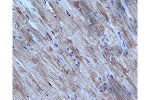 ABIN6276298 at 1/200 staining rat heart tissue sections by IHC-P.