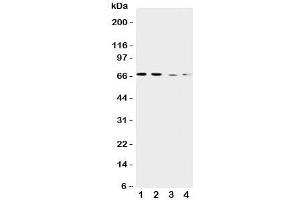 Western blot testing of CAT1 antibody and Lane 1:  human placenta;  2: HeLa;  3: SKOV-3;  4: HT1080 cell lysate.