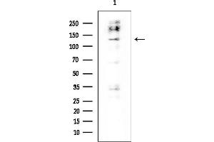 Western blot analysis of lysates from HUVEC cells, using HIPK2 Mouse Monoclonal Antibody at 1/1000 dilution.