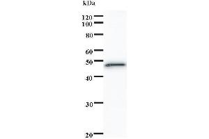 Western Blotting (WB) image for anti-SATB Homeobox 1 (SATB1) antibody (ABIN932488) (SATB1 anticorps)