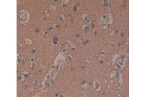 Used in DAB staining on fromalin fixed paraffin- embedded Kidney tissue (SNAP25 anticorps  (AA 1-206))
