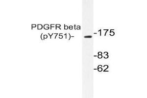 Western blot (WB) analysis of p-PDGFR beta antibody in extracts from NIH/3T3 PDGF cells . (PDGFRB anticorps  (pTyr751))
