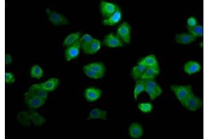Immunofluorescence staining of HepG2 cells with ABIN7144968 at 1:166, counter-stained with DAPI. (RECQL4 anticorps  (AA 200-337))