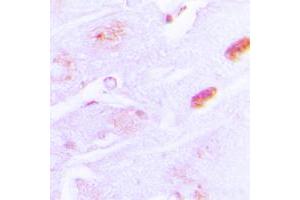Immunohistochemical analysis of Amylin staining in human brain formalin fixed paraffin embedded tissue section. (Amylin/DAP anticorps  (N-Term))