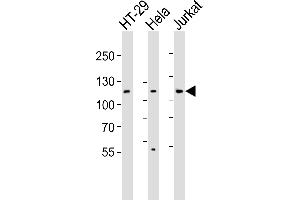 Western blot analysis of lysates from HT-29, Hela, Jurkat cell line (from left to right), using JAK1 Antibody (N-term) (ABIN6242901 and ABIN6577480). (JAK1 anticorps  (N-Term))