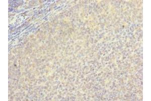 Immunohistochemistry of paraffin-embedded human tonsil tissue using ABIN7145628 at dilution of 1:100 (LOH12CR1 anticorps  (AA 1-196))