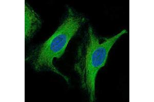 Immunofluorescence analysis of HeLa cells using β-tubulin antibody (green). (TUBB anticorps)