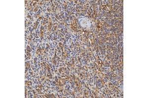 IHC analysis of RAB7/RAB7A using anti-RAB7/RAB7A antibody (ABIN7600597). (RAB7A anticorps  (AA 21-177))