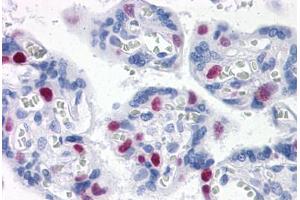 Human Placenta: Formalin-Fixed, Paraffin-Embedded (FFPE)