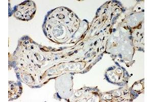 IHC-P: Optineurin antibody testing of human placenta tissue