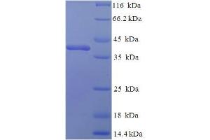 SDS-PAGE (SDS) image for Complement Component 1, Q Subcomponent, A Chain (C1QA) (AA 23-245) protein (His-SUMO Tag) (ABIN5709165)