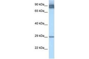 Image no. 1 for anti-Lecithin Retinol Acyltransferase (Phosphatidylcholine--Retinol O-Acyltransferase) (LRAT) (AA 51-100) antibody (ABIN6747475) (LRAT anticorps  (AA 51-100))