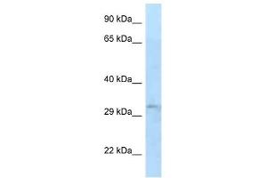 Western Blot showing TIPRL antibody used at a concentration of 1 ug/ml against 721_B Cell Lysate