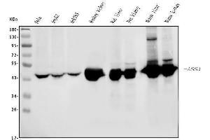 Western blot analysis of ASS1 using anti-ASS1 antibody (ABIN7601191).
