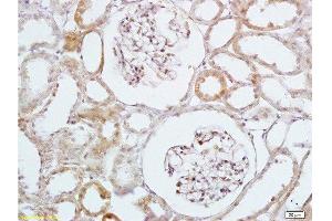 Formalin-fixed and paraffin embedded rat kidney labeled with Anti-HB EGF Polyclonal Antibody, Unconjugated  at 1:200 followed by conjugation to the secondary antibody and DAB staining