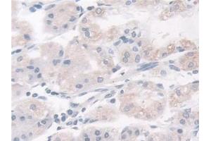 Detection of BCAR1 in Human Stomach Tissue using Polyclonal Antibody to Breast Cancer Anti-Estrogen Resistance 1 (BCAR1)