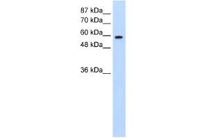 WB Suggested Anti-DAZ2 Antibody Titration:  0. (DAZ2 anticorps  (N-Term))