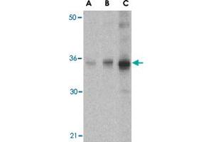 Western blot analysis of SOCS1 in human spleen tissue lysate with SOCS1 polyclonal antibody  at (A) 1, (B) 2 and (C) 4 ug/mL . (SOCS1 anticorps  (N-Term))