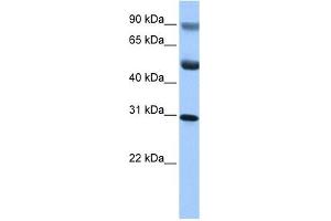 C17ORF39 antibody used at 1 ug/ml to detect target protein.