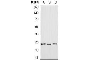 Western blot analysis of ARF6 expression in HeLa (A), mouse liver (B), rat spleen (C) whole cell lysates. (ARF6 anticorps  (Center))