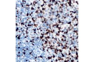 Immunohistochemical analysis of ANKRD1 staining in human lymph node formalin fixed paraffin embedded tissue section. (ANKRD1 anticorps  (C-Term))