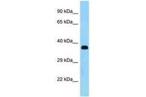Image no. 1 for anti-Keratocan (KERA) (AA 196-245) antibody (ABIN1493172)