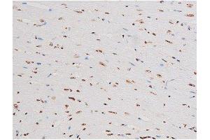 ABIN6267601 at 1/200 staining Mouse heart tissue sections by IHC-P.