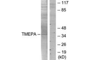 Western blot analysis of extracts from HT-29 cells, using TMEPA Antibody. (TMEPA (AA 101-150) anticorps)