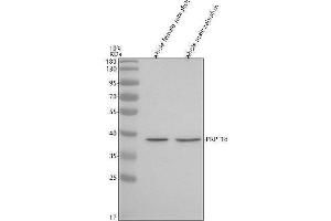 Western blot analysis of PRPF18 using anti-PRPF18 antibody (AZQ6GMH0).