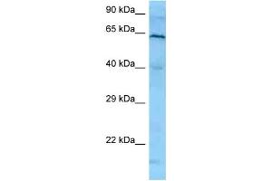 WB Suggested Anti-PLK1 Antibody   Titration: 1. (PLK1 anticorps  (N-Term))