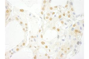 Immunohistochemistry (IHC) image for anti-Serine/threonine-Protein Kinase PRP4 Homolog (PRPF4B) (AA 1-50) antibody (ABIN7448746)