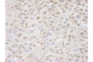 Immunohistochemistry (IHC) image for anti-CSE1 Chromosome Segregation 1-Like (CSE1L) (AA 1-50) antibody (ABIN7448490) (Exportin 2 anticorps  (AA 1-50))