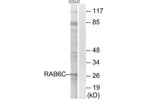 Western Blotting (WB) image for anti-RAB6C (WTH3DI) (Internal Region) antibody (ABIN1851986) (WTH3DI anticorps  (Internal Region))