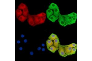 ABIN7096452 and ABIN7100516 staining Hela cells by IF/ICC. (GFPT2 anticorps)