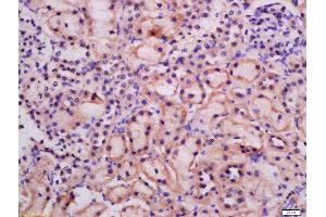 Formalin-fixed and paraffin embedded rat kidney labeled with Rabbit Anti-ATG9A Polyclonal Antibody, Unconjugated  at 1:200 followed by conjugation to the secondary antibody and DAB staining (ATG9A anticorps  (AA 301-400))