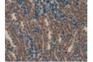 IHC-P analysis of Rat Kidney Tissue, with DAB staining. (aHSP anticorps  (AA 2-102))