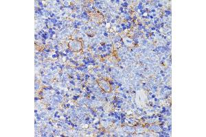 Immunohistochemistry of paraffin-embedded mouse spleen using SN antibody (ABIN7270670) at dilution of 1:100 (40x lens). (SNAP23 anticorps  (AA 1-211))
