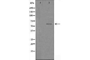 Western blot analysis of extracts from HUVEC cells, using TCF4/12 antibody. (TCF4/12 anticorps)