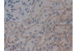 Detection of PXN in Rat Kidney Tissue using Polyclonal Antibody to Paxillin (PXN)