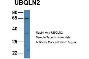 Host: Rabbit Target Name: UBQLN2 Sample Type: Hela Antibody Dilution: 1. (Ubiquilin 2 anticorps  (N-Term))