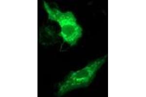 Immunofluorescence (IF) image for anti-Methylmalonic Aciduria (Cobalamin Deficiency) CblB Type (MMAB) antibody (ABIN1499507) (MMAB anticorps)
